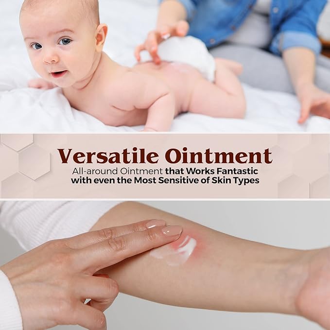 MEDca Vitamin A & D Diaper Rash Ointment- Protectant Cream For Sensitive Baby Skin - Lanolin & Petrolatum Formula, Dry-Cracked Hands/Feet/Face Skin, 1oz Tube, Bulk Case of 72
