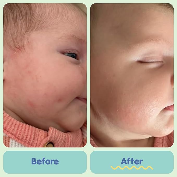 TUBBY TODD All Over Ointment Baby Eczema Cream, Everyday Multi-Purpose Baby Skin Relief Cream, Sensitive and Dry Skin, Rash & Irritation - Steroid & Gluten Free, Fragrance-Free, 8 oz, 2 Pack